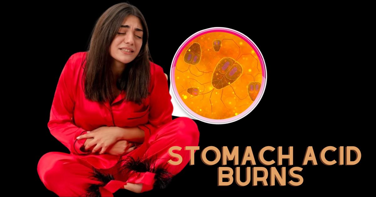 Stomach-Acid-Burns-on-Skin 